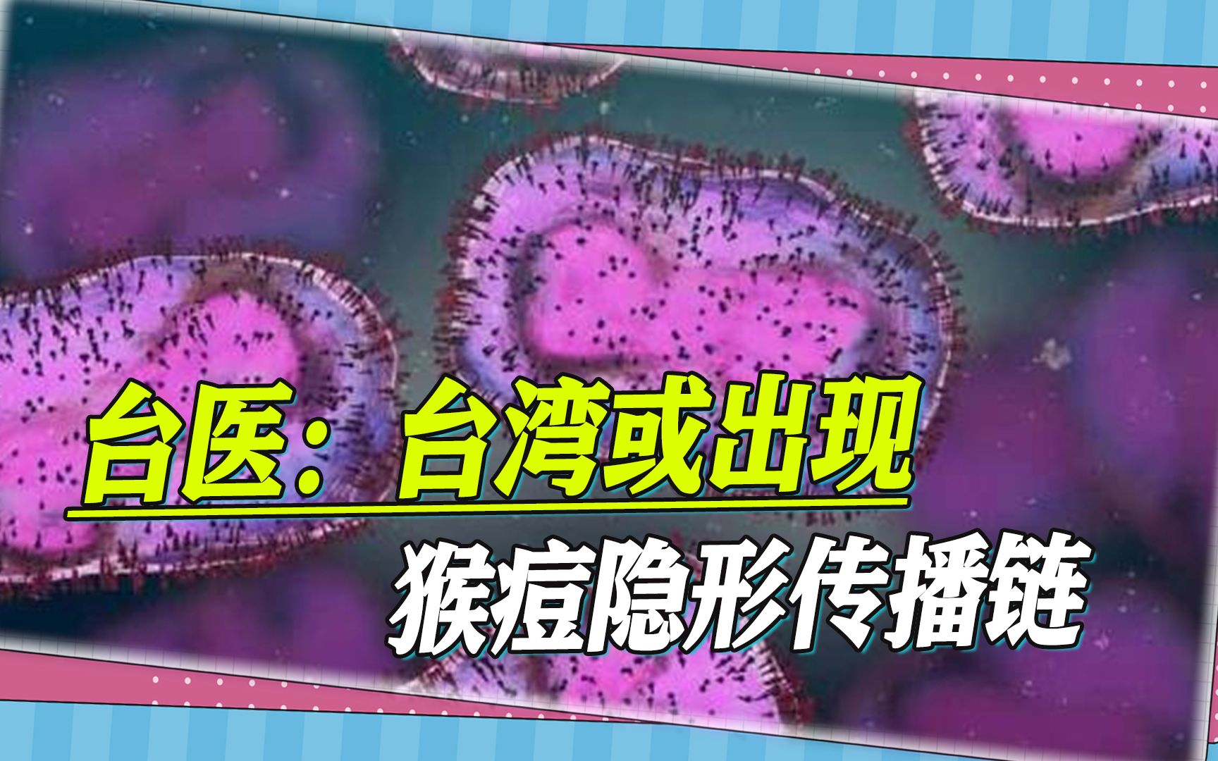 台湾首见猴痘本土案例，2名壮年男子感染，或已出现隐形传播链
